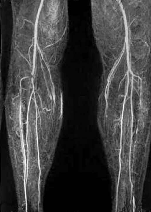 Damascus X -Ray