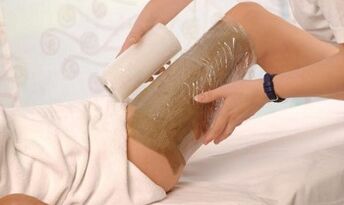 Lotions and compresses for the treatment of varicose veins
