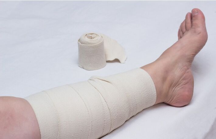 foot compression bandage for varicose veins