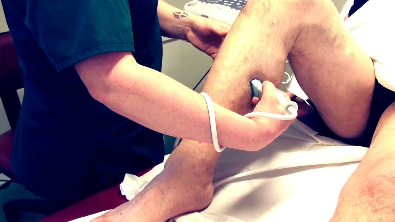 Duplex scanning of the vessels of the lower extremities for the diagnosis of varicose veins