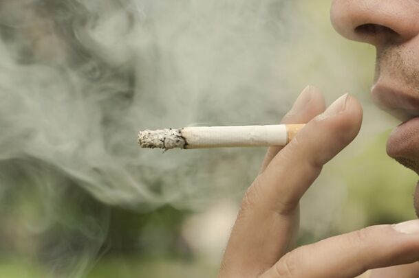 Smoking is one of the reasons for the development of reticular varicose veins
